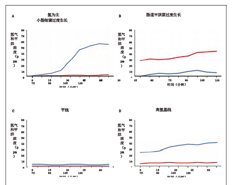 小肠细菌过度生长和肠道产甲烷菌过度生长的呼吸试验的利与弊（翻译）